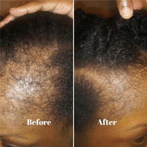 Peppermint Herbal Hair Balm | 20+ Oils & Herbs with Shea Butter, Aloe & Castor